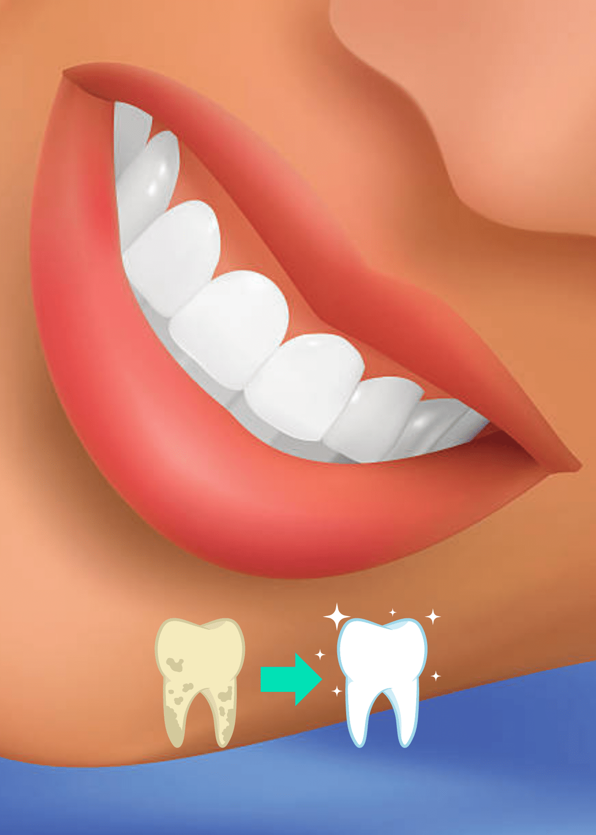 Snow Teeth Whitening System Review: The Best Teeth Whitening Product?